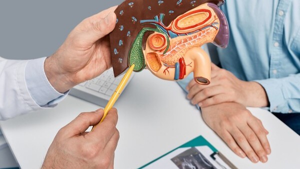 식사 자주 거르고 과한 다이어트, 몸속에 돌 생깁니다